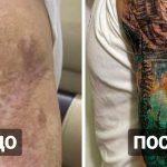 20 tattoos over scars and burns that have helped people turn their blemishes into a highlight