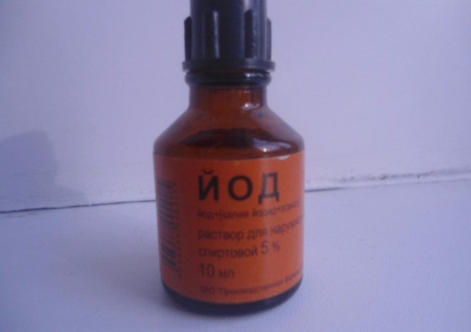 5% de yodo para la eliminación de tatuajes sin quemaduras