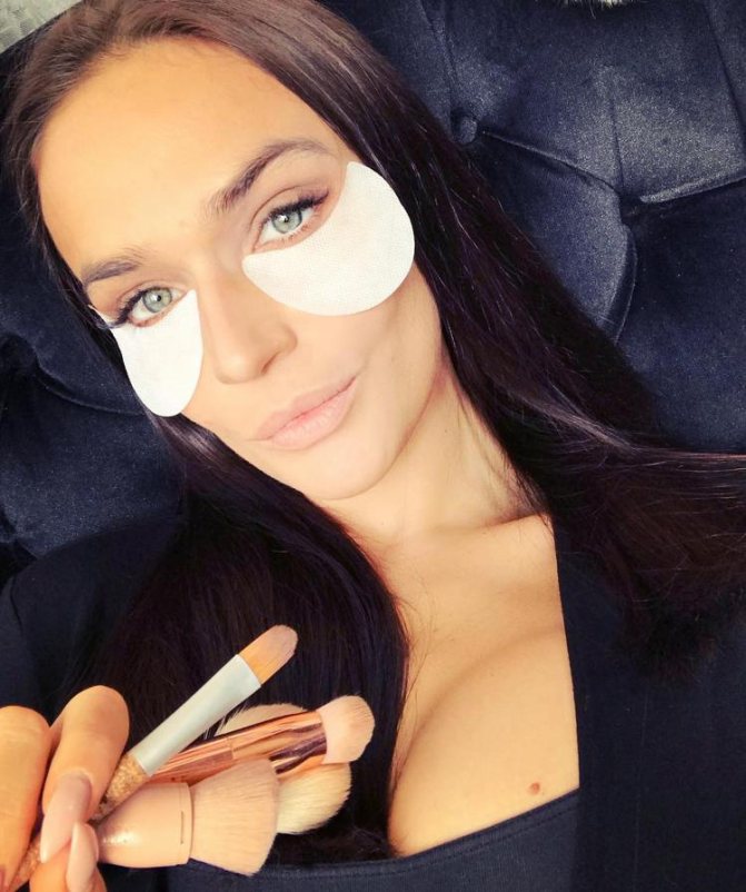 Alena Vodonaeva with patches under her eyes