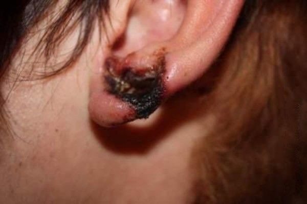 Does it hurt to make tunnels in the ears