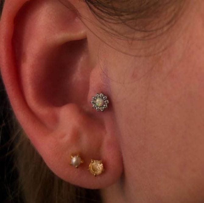 Tut es weh, ein Ohrläppchen zu durchstechen?