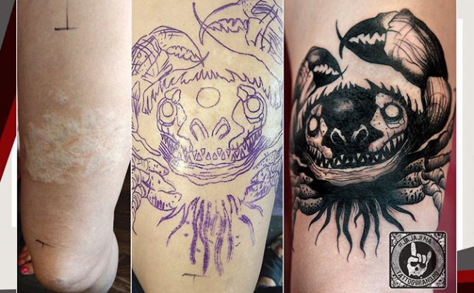 Черни графики за татуировки върху белези