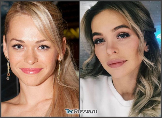 Masha z Univer před a po operaci