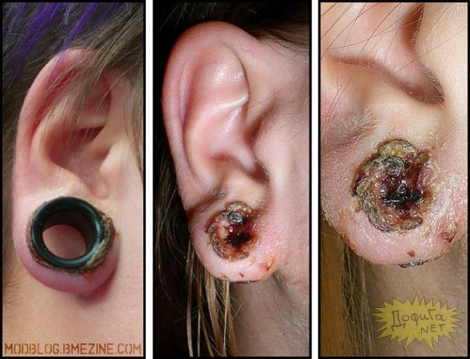 Photo from the site: ovulation.org.ua