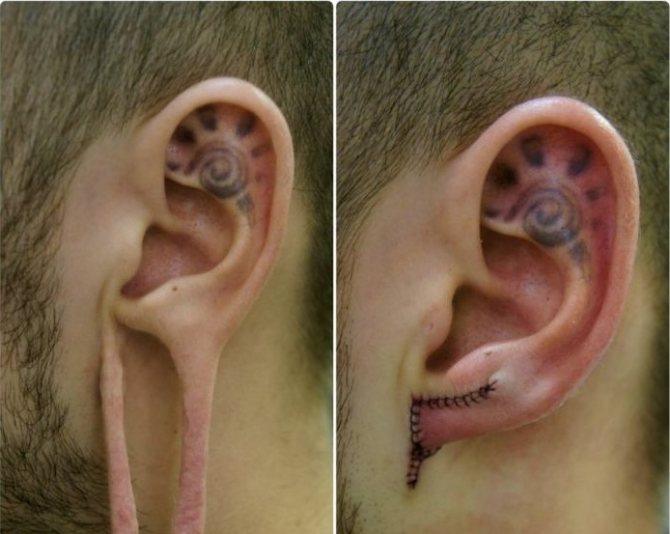 Photo from the site: pikabu.ru