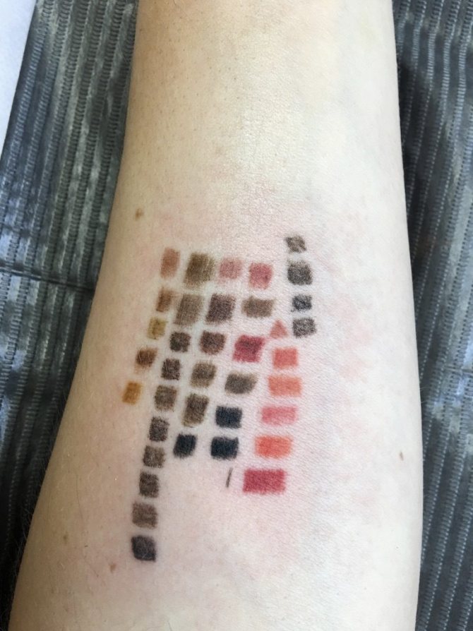 Inversion pigmentaire