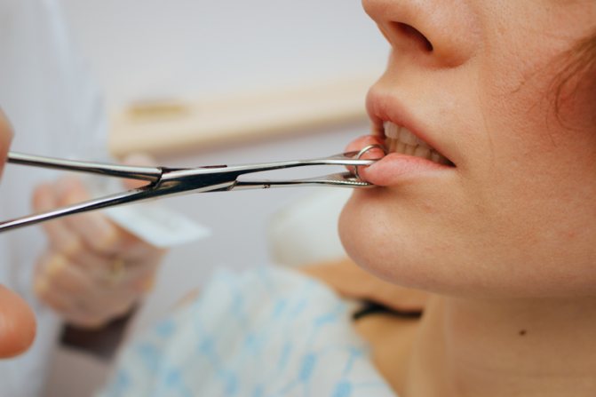 Comment faire un labret vertical