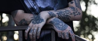 ¿Cómo puedo eliminar un tatuaje?