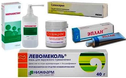 Comment percer correctement les oreilles sur les pointes. Schéma, photo