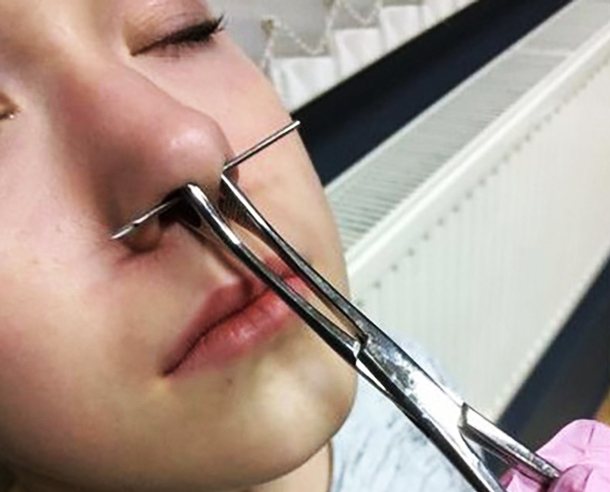 Hogyan kell piercinget szúrni egy septum piercinget otthon