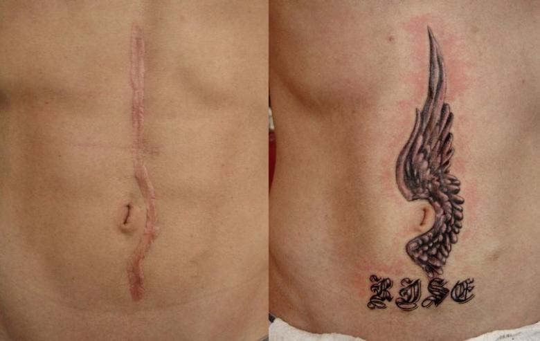 comment cacher une cicatrice de colliole