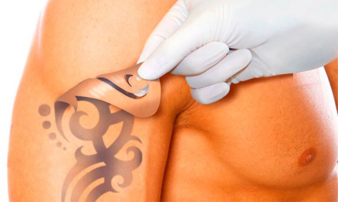 Cómo eliminar un tatuaje en casa