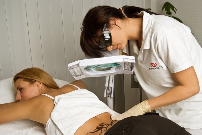 hvordan man reducerer tatovering