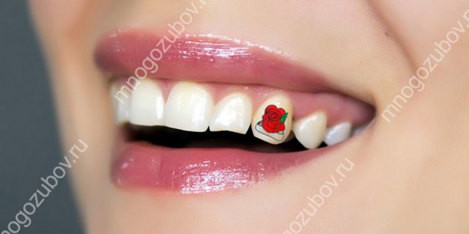 歯に刻まれた刺青はどのようなものか