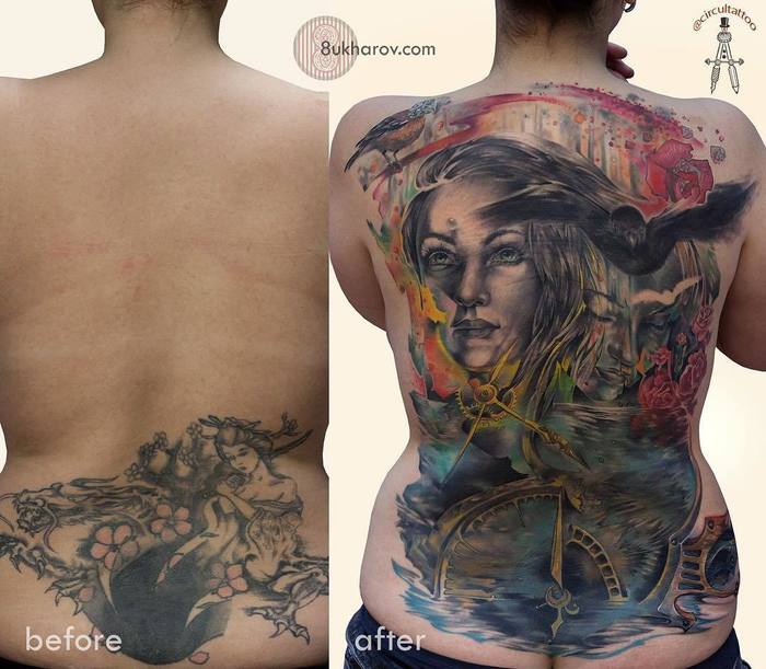 eliminación de tatuajes en la espalda