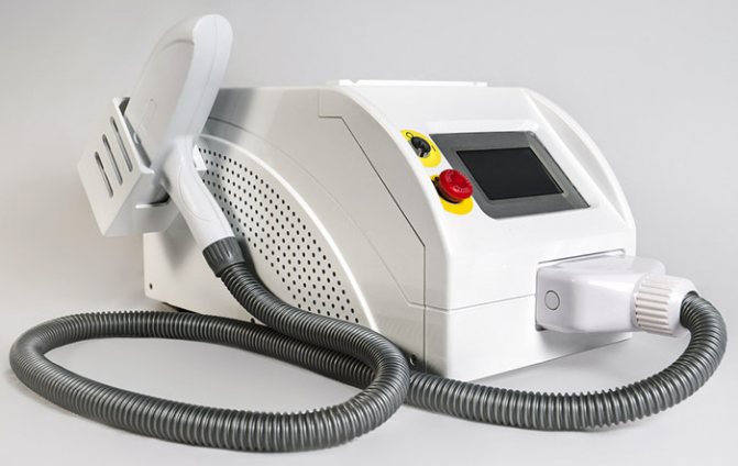 Fjernelse af tatoveringer med laser. Anmeldelser, før og efter billeder