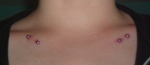 鎖骨の微小皮膜