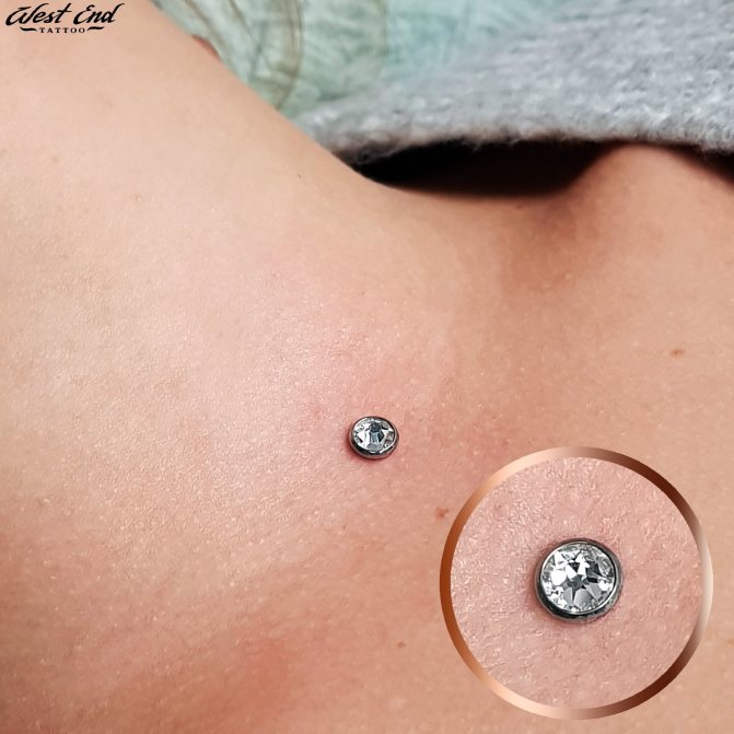 Microdermique sur la clavicule