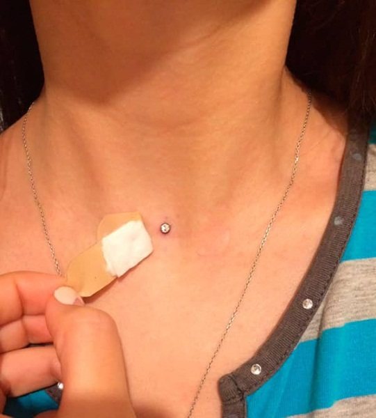 首、顔、腕、胸、鎖骨、腰のマイクロダーマル。なんだろう、フォトピアス。作り方・直し方