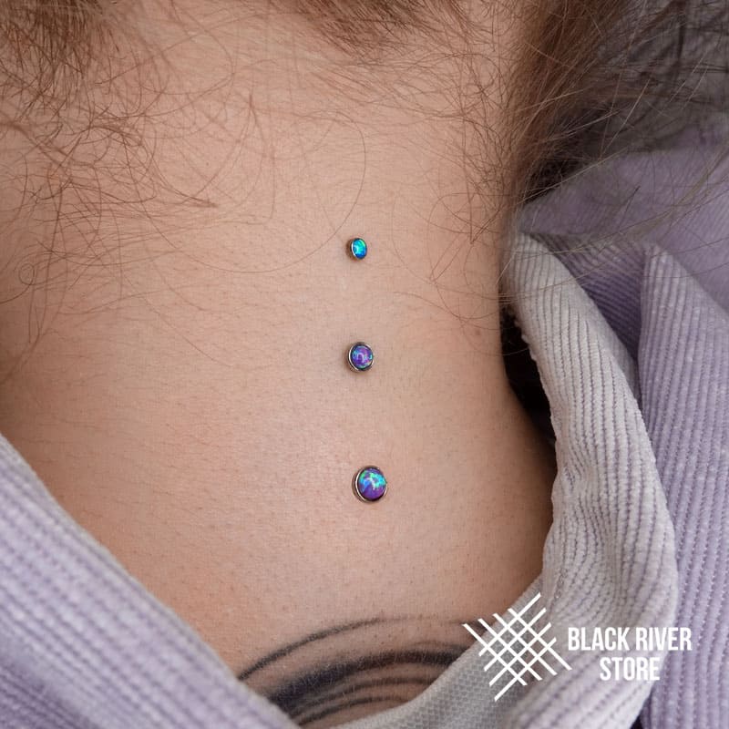 микродермален