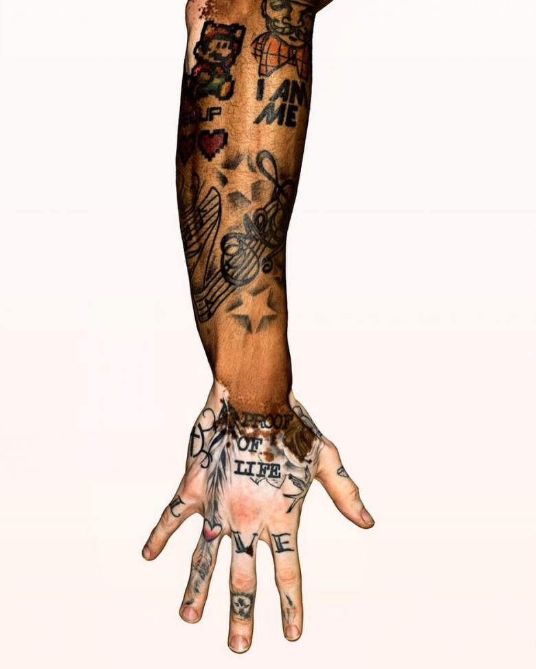 ¿Puedo hacerme un tatuaje en una piel con acné, vitíligo, lunares o marcas de nacimiento?