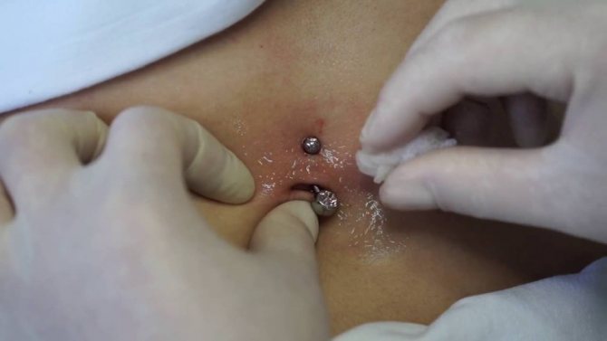Piercing treatment