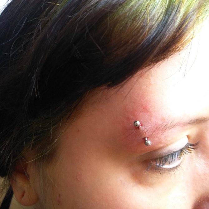 Пиърсинг на подпухнали вежди
