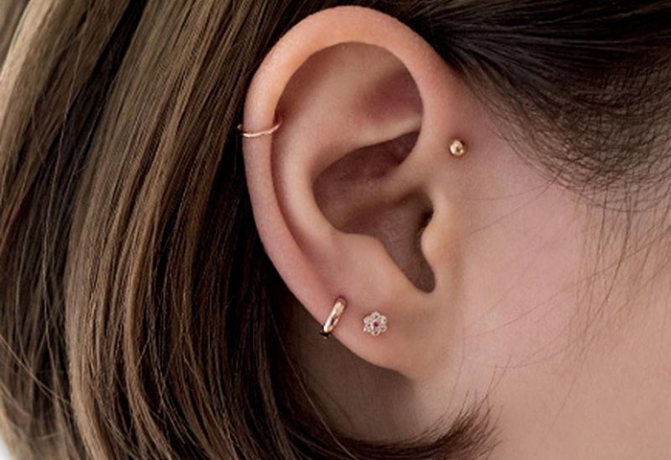 Specificità della puntura