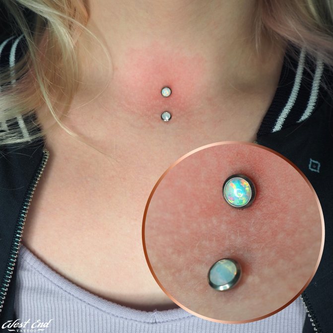 The first stage of piercing healing