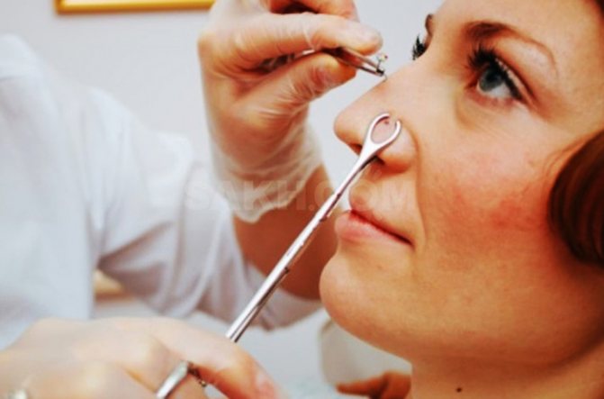 Wing nail nose piercing. Name, home care, reviews