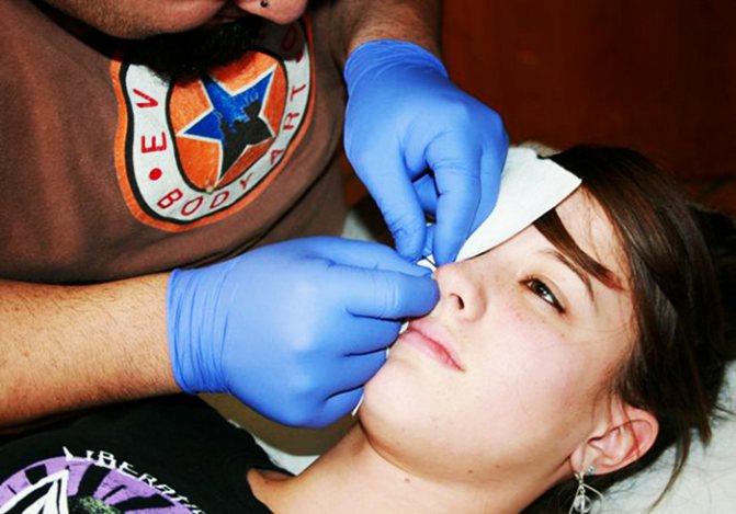 Perçage de l'aile de l'ongle. Nom, soins à domicile, commentaires