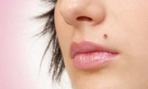 conséquences du piercing de monroe