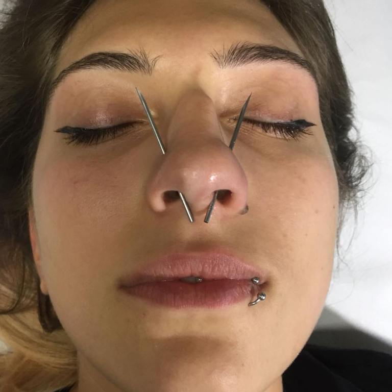 Pirsing nosa 41188C7 - Orrlyukasztás