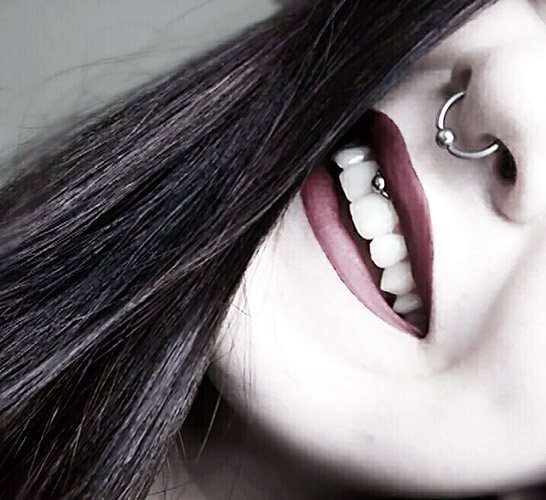 Σκουλαρίκι κάτω από το άνω χείλος (χαμόγελο) στο frenulum. Φωτογραφίες, συνέπειες, κριτικές