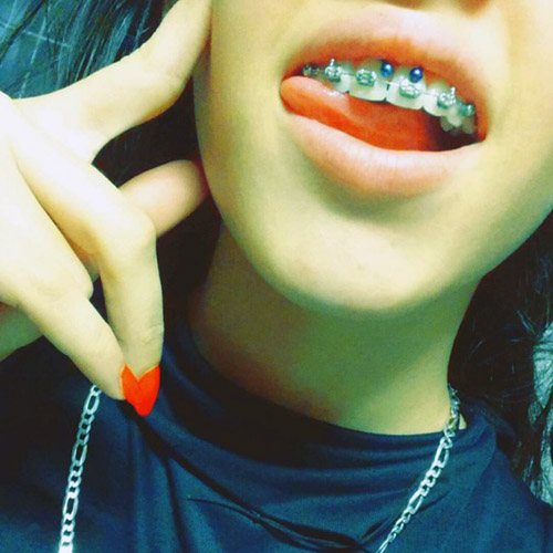 Σκουλαρίκι κάτω από το άνω χείλος (smiley) στο frenulum. Φωτογραφίες, συνέπειες, κριτικές