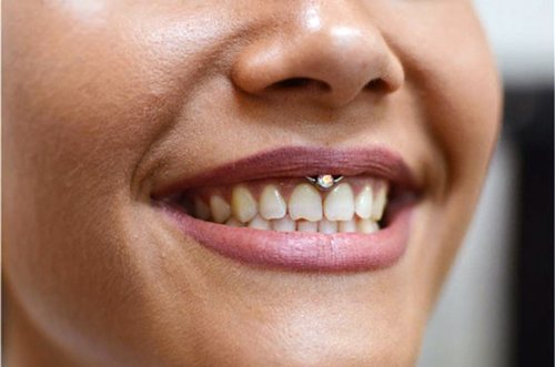 Σκουλαρίκι κάτω από το άνω χείλος (smiley) στο frenulum. Φωτογραφίες, συνέπειες, κριτικές