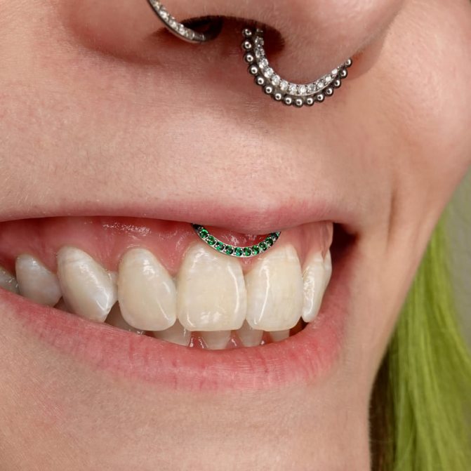 пиърсинг на усмивката, пиърсинг на преградата, пиърсинг на носа