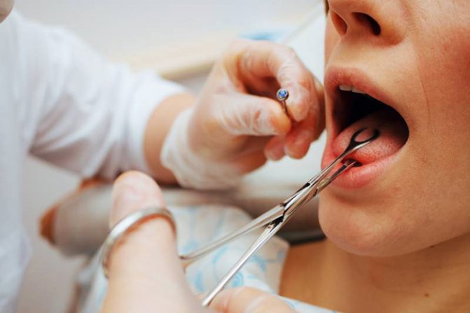 Tongue Piercing rod. Photo, que choisir, la taille de l'ornement, l'entretien