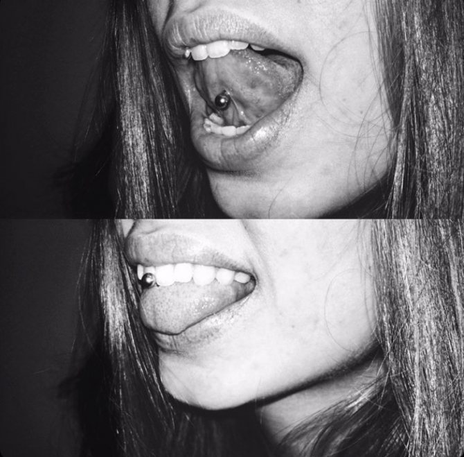 perçage de la langue