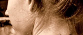 planar neck piercing