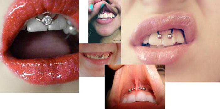 Σκέψεις για το piercing του χαμόγελου