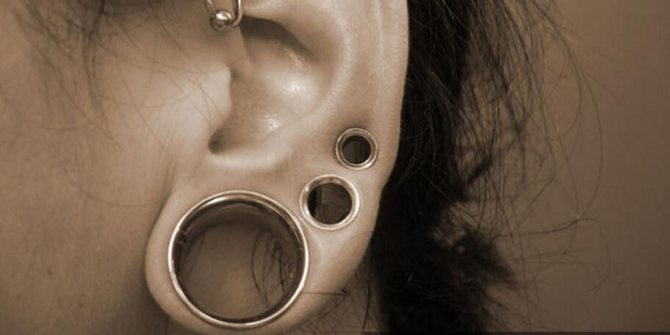 Example of multiple tunnels on an earlobe
