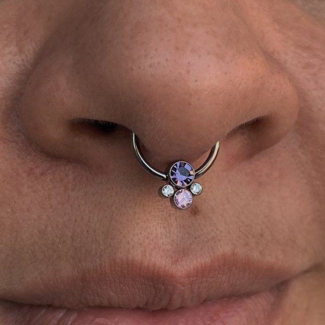 septum puncture photo