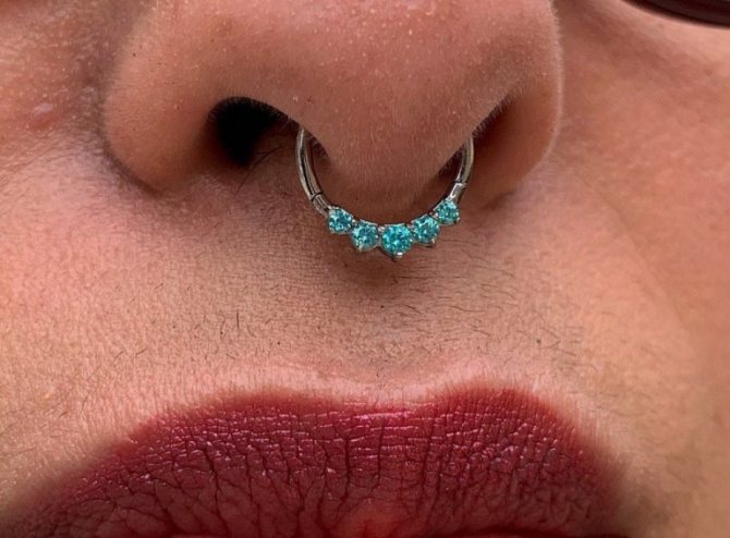 vaheseina augustamine