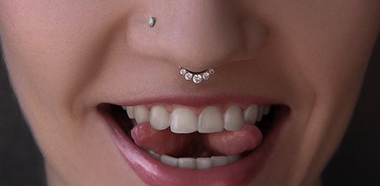 perforation du septum