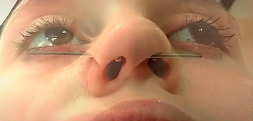 auto-perçage à domicile