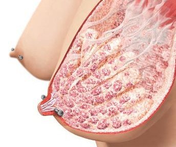 Piercing mellbimbók piercing lányoknál. Képek, vélemények