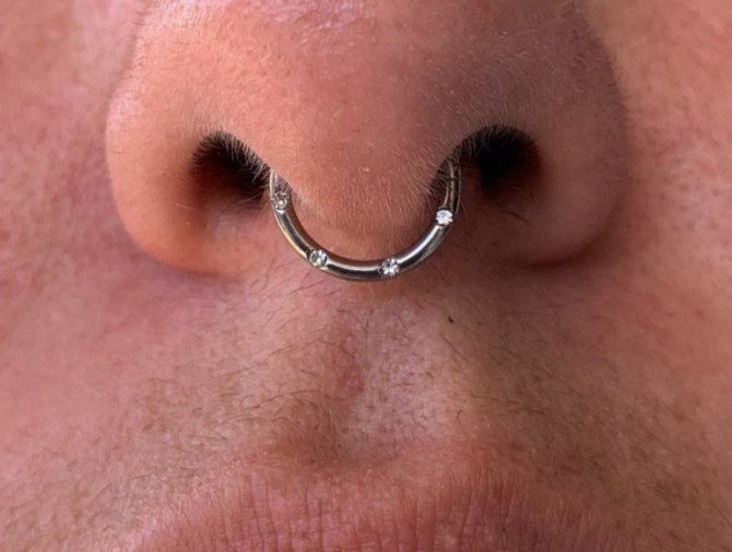 septum photo