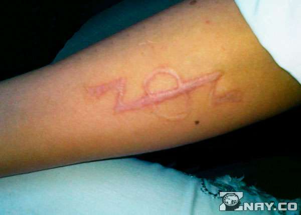 Arvet kuvion muodossa käsivarressa.