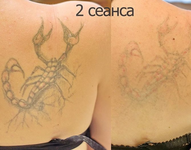 hvor mange sessioner har jeg brug for